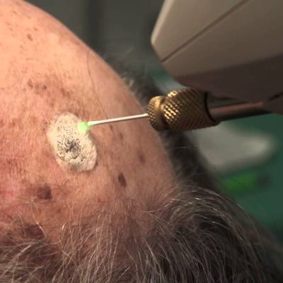 clinica dermatologica