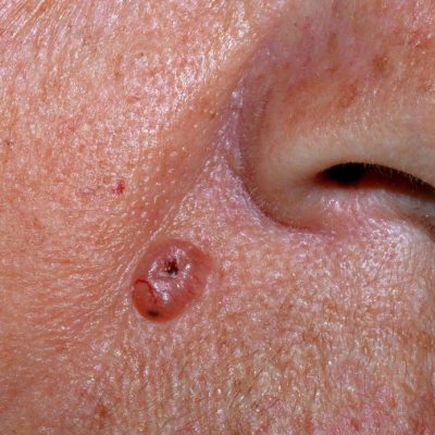 clinica dermatologica
