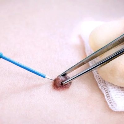 clinica dermatologica