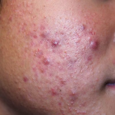 clinica dermatologica