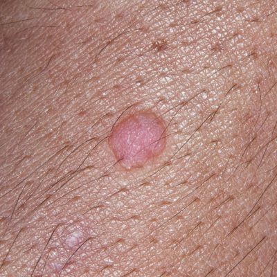 clinica dermatologica