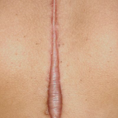 clinica dermatologica