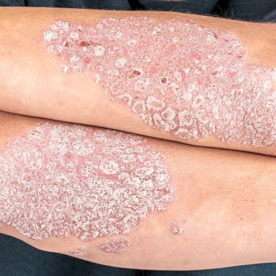 clinica dermatologica