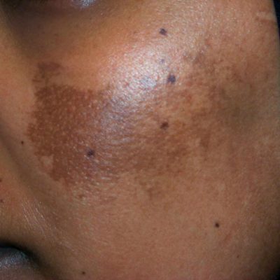 clinica dermatologica